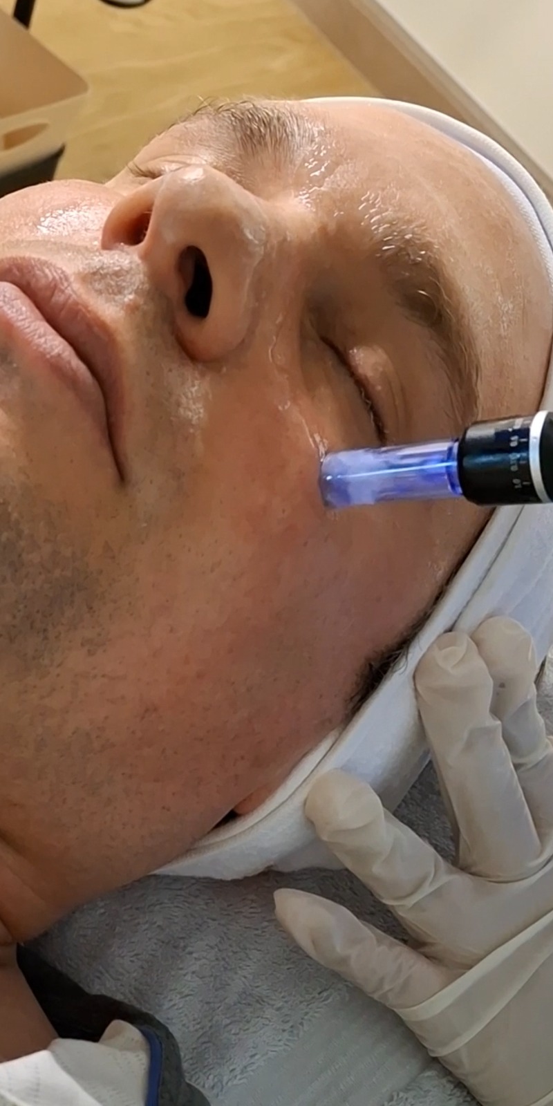 NANO INFUSION FACIAL